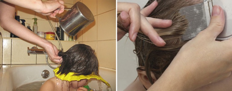 Как развести уксус для ополаскивания волос от вшей и гнид